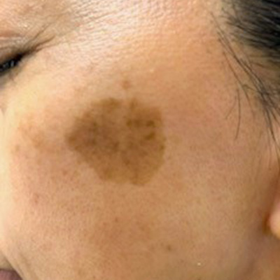 Dr.PUR BEAUTEご利用前