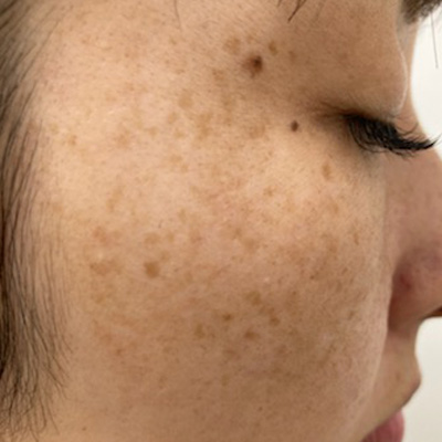 Dr.PUR BEAUTEご利用前