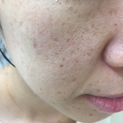 Dr.PUR BEAUTEご利用前