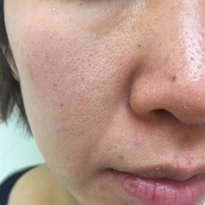 Dr.PUR BEAUTEご利用後